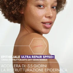 A-derma Epitheliale Ultra Ha+ Repair Spf50+ Crema Ristrutturante Anti-segni 40ml