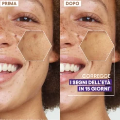 A-derma Epitheliale Ultra Repair Siero Ristrutturante Luminosità Anti-macchie Vitamina C 30ml