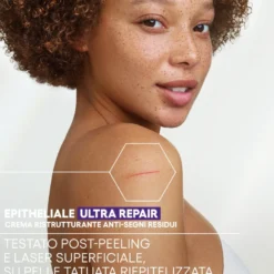 A-derma Epitheliale Ultra Repair Crema Ristrutturante Anti Segni Residui 40ml