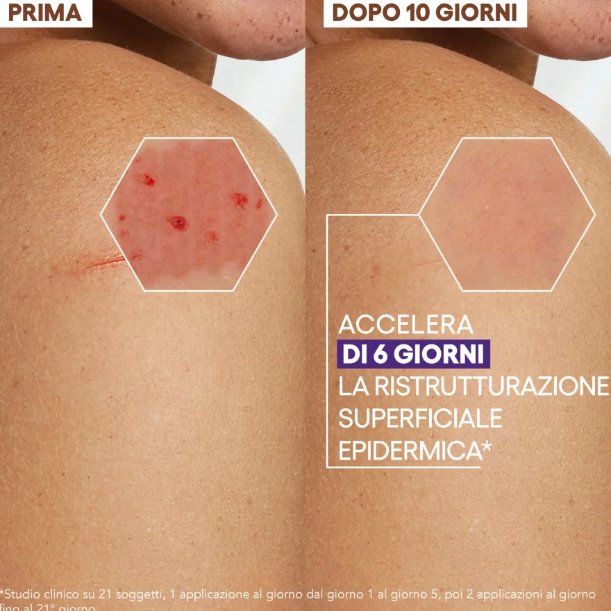 A-derma Epitheliale Ultra Repair Crema Ristrutturante Anti Segni Residui 40ml
