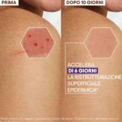 A-derma Epitheliale Ultra Repair Crema Ristrutturante Anti Segni Residui 100ml