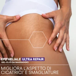 A-derma Epitheliale Ultra Repair Gel-olio Da Massaggio Cicatrici E Smagliature 40ml