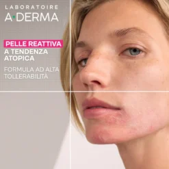 A-derma Exomega Viso Gel-crema Lenitiva Pelle Reattiva E Atopica 40ml