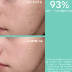 Apivita Just Bee Clear Crema Viso Idratante Opacizzante Anti-imperfezioni Pelle Grassa Acne 40ml