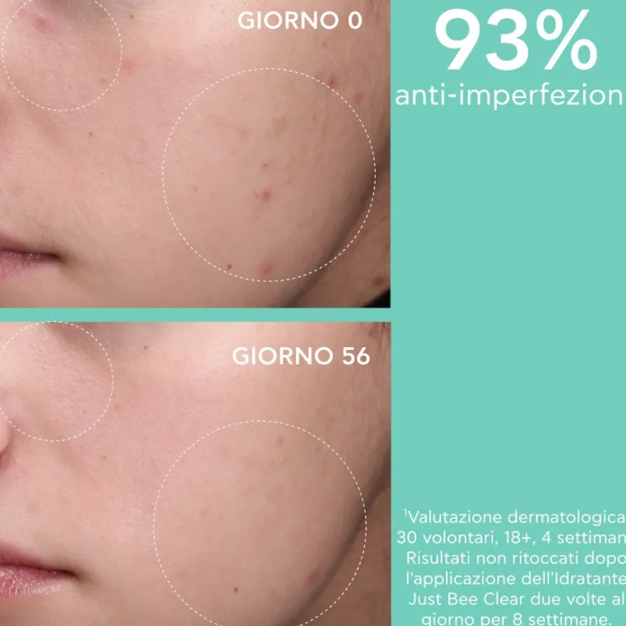 Apivita Just Bee Clear Crema Viso Idratante Opacizzante Anti-imperfezioni Pelle Grassa Acne 40ml