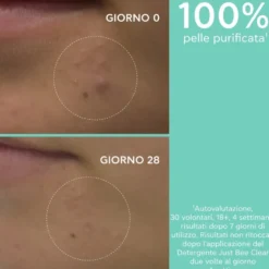 Apivita Just Bee Clear Gel Detergente Viso Purificante Per Pelle Grassa Acne Imperfezioni 200ml