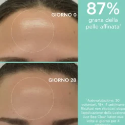 Apivita Just Bee Clear Lozione Purificante Per Pelle Grassa Acne Imperfezioni Macchie E Brufoli 200ml