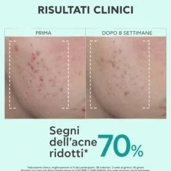 Apivita Just Bee Clear Siero Perfezionatore Affinante E Anti-macchie Opacizzante Pelle Grassa Acne 30ml