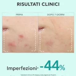 Apivita Just Bee Clear Siero Perfezionatore Affinante E Anti-macchie Opacizzante Pelle Grassa Acne 30ml