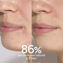Caudalie Vinopure siero Anti Imperfezioni bipacco 2x30ml