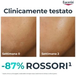 Eucerin Dermopure Clinical Trattamento Lenitivo Anti Rossori Pelle A Tendenza Acneica 40ml