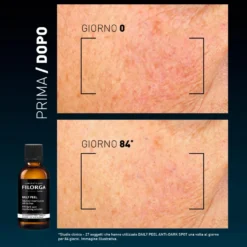 Filorga Daily Peel Dark Spot Soluzione Rinnovatrice Anti Macchie 50ml