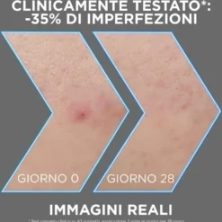 Garnier Pureactive Siero Aha+bha Anti-imperfezioni 30ml