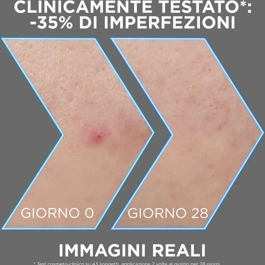 Garnier Pureactive Siero Aha+bha Anti-imperfezioni 30ml