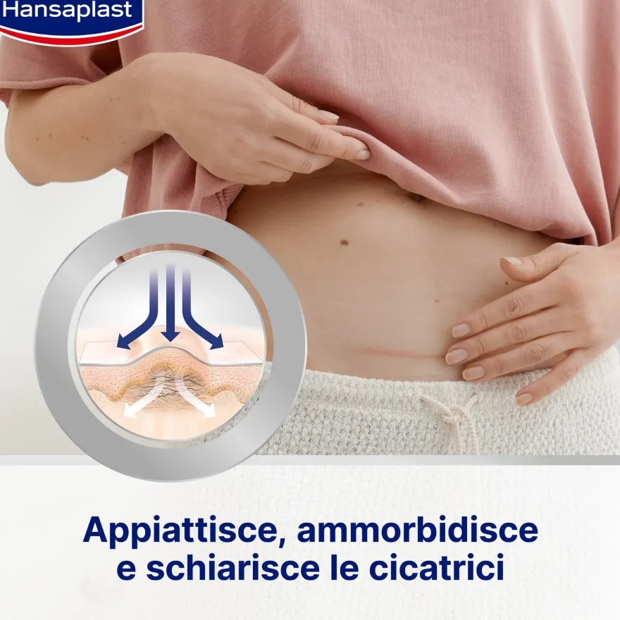 Hansaplast Cerotti Riduzione Delle Cicatrici Xl 21 Pezzi Da 3 X 14,6cm