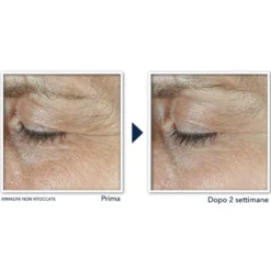 Roc Derm Correxion Crema Contorno Occhi Doppia Azione 2x10ml