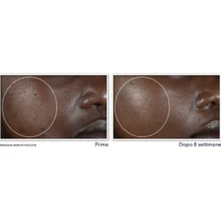 Roc Multi Correxion Even Tone + Lift Crema Notte 50ml