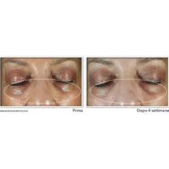 Roc Multi Correxion Even Tone + Lift Crema Contorno Occhi 15ml