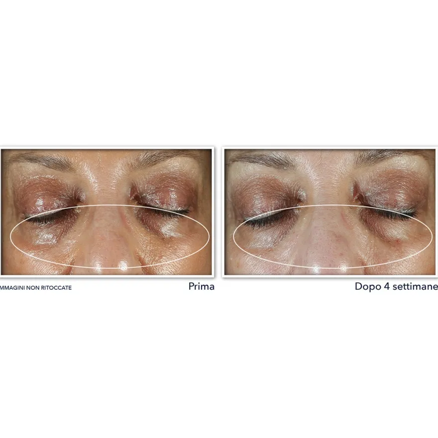 Roc Multi Correxion Even Tone + Lift Crema Contorno Occhi 15ml