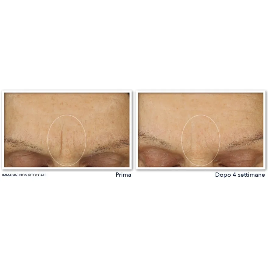 Roc Retinol Correxion Line Smoothing Crema Viso 50ml
