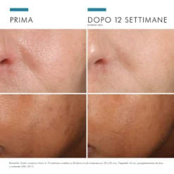 Skinceuticals Phloretin Cf Siero Antiossidante Per Pelli Iperpigmentate Con 10% Di Vitamina C Pura 30ml