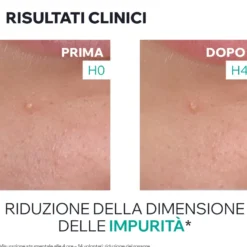 Uriage Hyseac Sos Gel Purificante Anti-imperfezioni 15ml